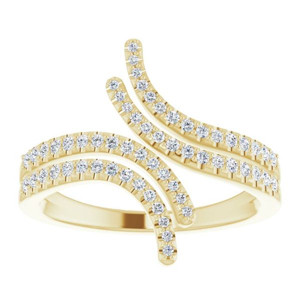 Bypass Ring - Image 3